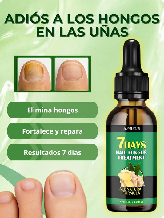 Recupera la Apariencia Saludable de tus Uñas Tratamiento Herbal para Hongos en las Uñas