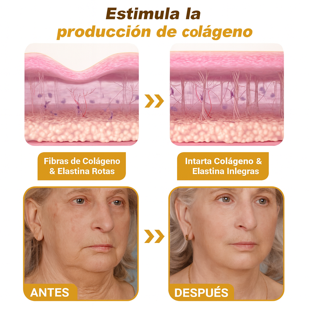 CREMA DE BOTOX VENENO DE ABEJA