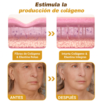 CREMA DE BOTOX VENENO DE ABEJA