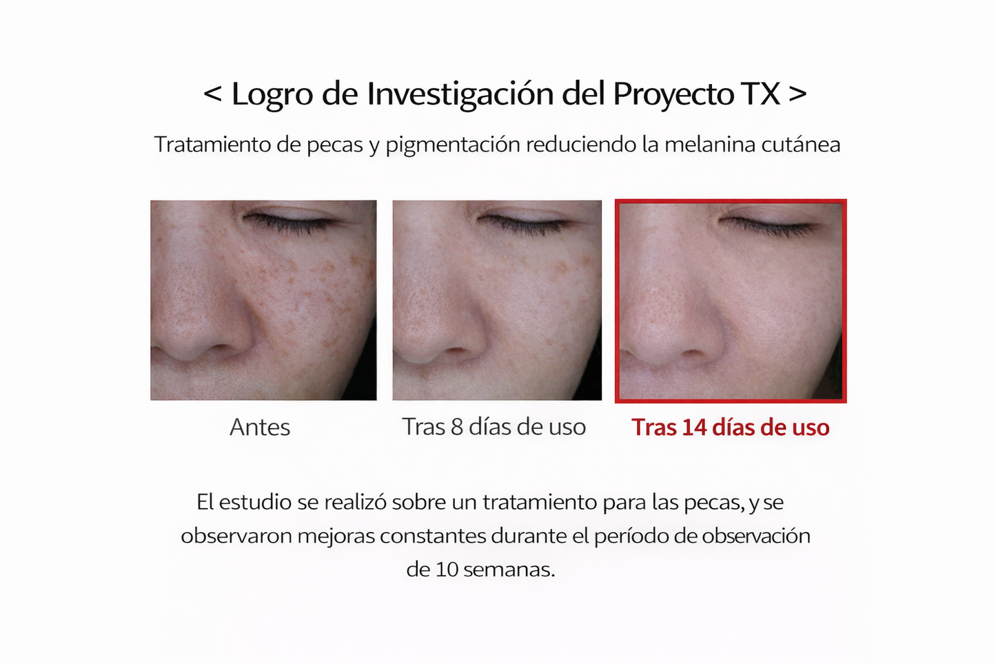 Crema Tranexámica DrMelaxin – Tratamiento para Manchas e Hiperpigmentación