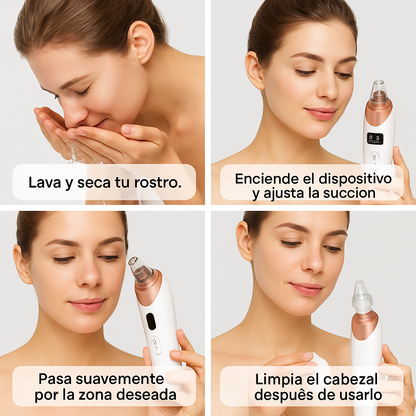 Succionador puntos negros