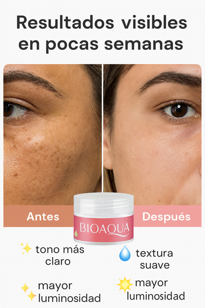 Crema Blanqueadora