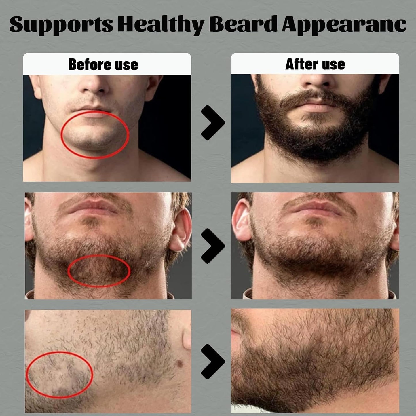 Bálsamo Estimulante Barba