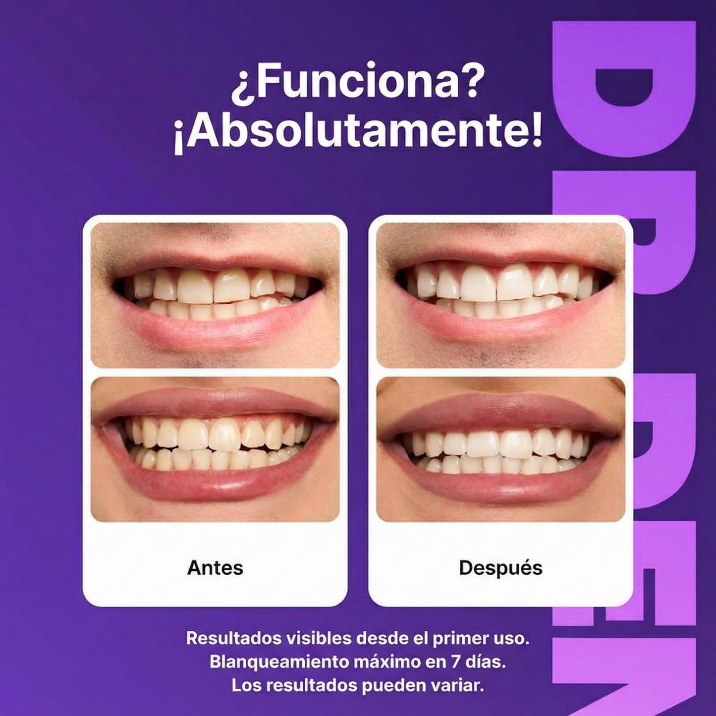 Vitali Sonrisa Radiante en Minutos