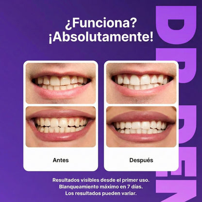 Vitali Sonrisa Radiante en Minutos
